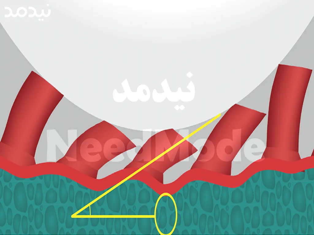 رویه راکت ایلیوس